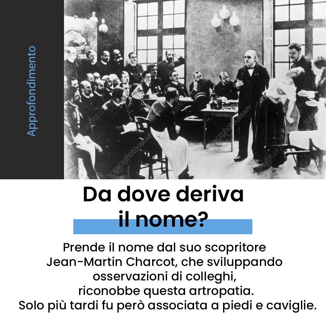 Piede di Charcot