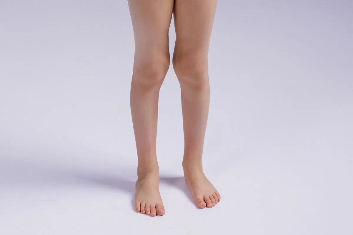 ginocchio valgo